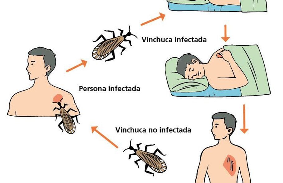 Medidas preventivas del mal de chagas