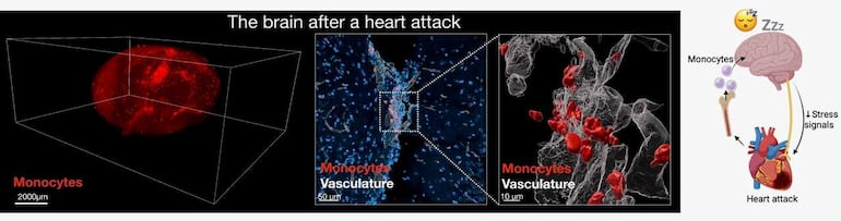 El corazón envía después de sufrir un infarto algunas señales al cerebro para desencadenar unos mayores deseos de dormir y acelerar así el proceso de recuperación, ya que ese descanso puede contribuir a reducir la inflamación.Lo han comprobado científicos del Hospital Mount Sinai de Nueva York, uno de los centros de referencia a nivel mundial en investigación y cirugía cardíaca y vascular, y los resultados de su trabajo, que este miércoles se publican en la revista Nature, demuestran por primera vez cómo corazón y cerebro se comunican entre sí a través del sistema inmunitario para favorecer el sueño y la recuperación tras un episodio cardiovascular grave.  En la imagen, comportamiento del cerebro de un ratón tras un infarto.