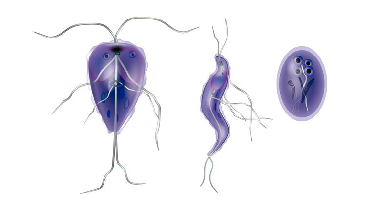 Infección causada por un parásito llamado Giardia lamblia.