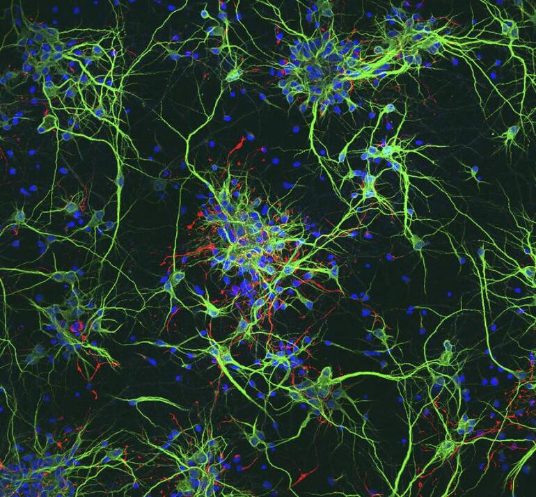 Científicas españolas han conseguido desarrollar un nuevo "biomaterial" que ha demostrado en los ensayos con células propiedades atractivas para recuperar tejido neural dañado, un importante avance según las investigadoras en la búsqueda de nuevas terapias para curar las lesiones medulares.