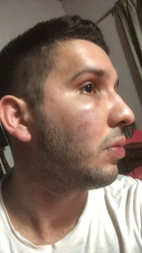 Rafel Méndez fue agredido a la salida de una discoteca y su padre pide la captura de sus agresores.