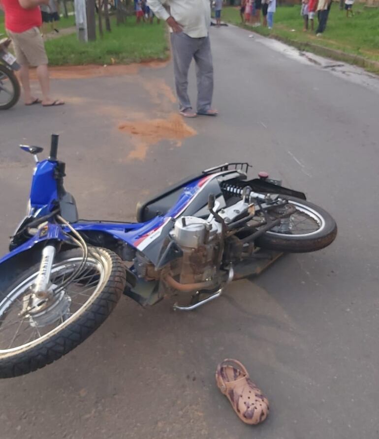 Choque entre motocicletas deja un fallecido en la tarde de este lunes, en la ciudad de Ñemby.