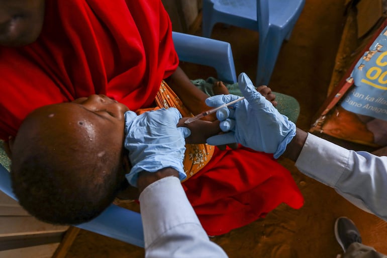 Un médico vacuna a un niño en las afueras de Dollow, Somalia, el pasado 30 de enero.