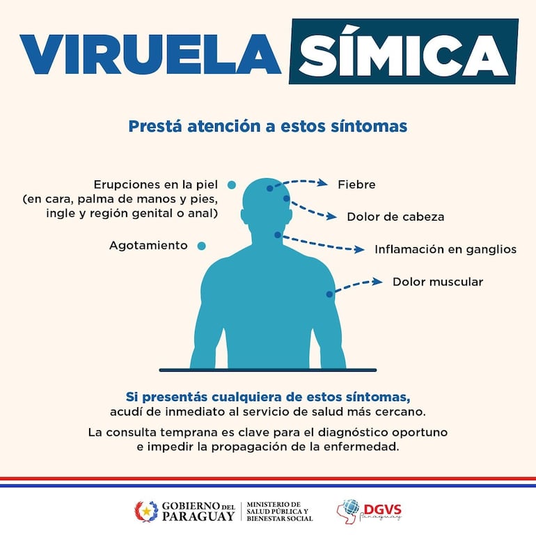 Síntomas de la viruela símica según el Ministerio de Salud.