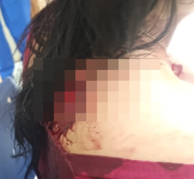 La mujer fue herida en varias partes del cuerpo por su hijastra.