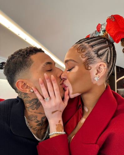 Winnie Harlow y Kyle Kuzma se comprometieron hace unos días.