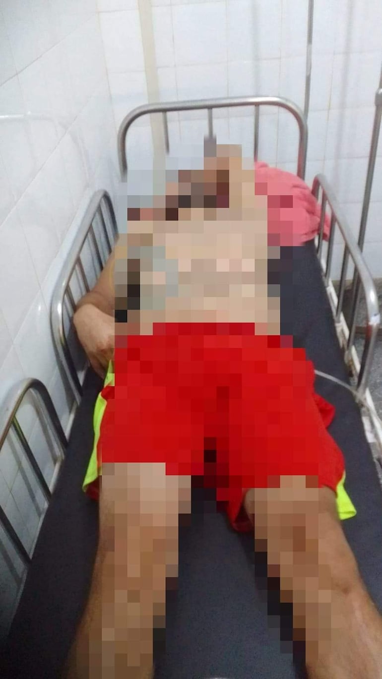 El hombre golpeado por su pareja fue derivado del Centro de Salud de Choré al Hospital de Santa Rosa del Aguaray.