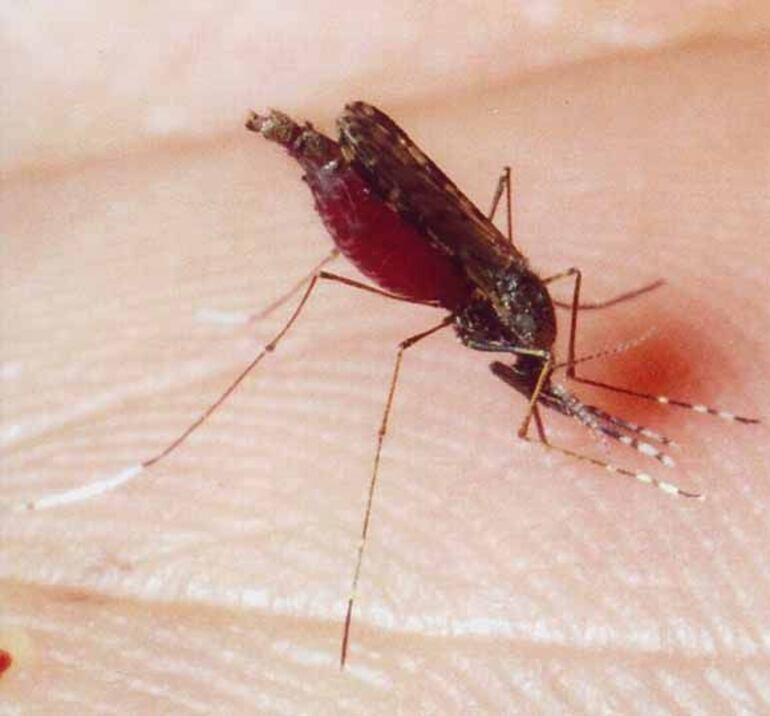 La inmunóloga camerunesa Rose Gana Fomban Leke ha sido galardonada en Berlín con el Premio Virchow de Salud Mundial por sus éxitos en la lucha contra enfermedades como la malaria y la polio, así como por su compromiso con la igualdad de género.