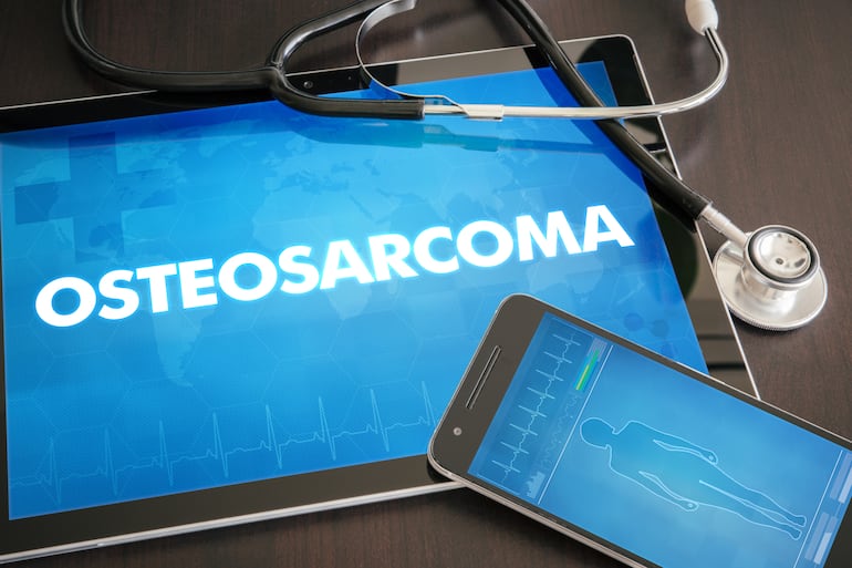 Osteosarcoma.