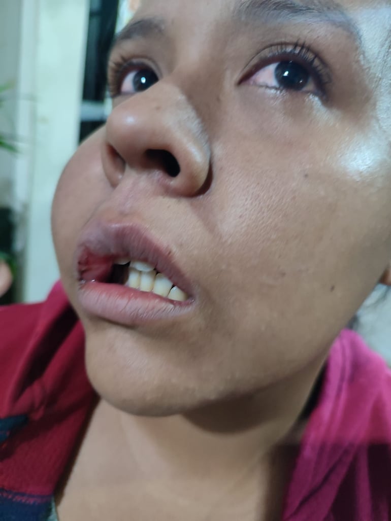 Así quedó el rostro de la mujer que fue agredida por su cuñado.