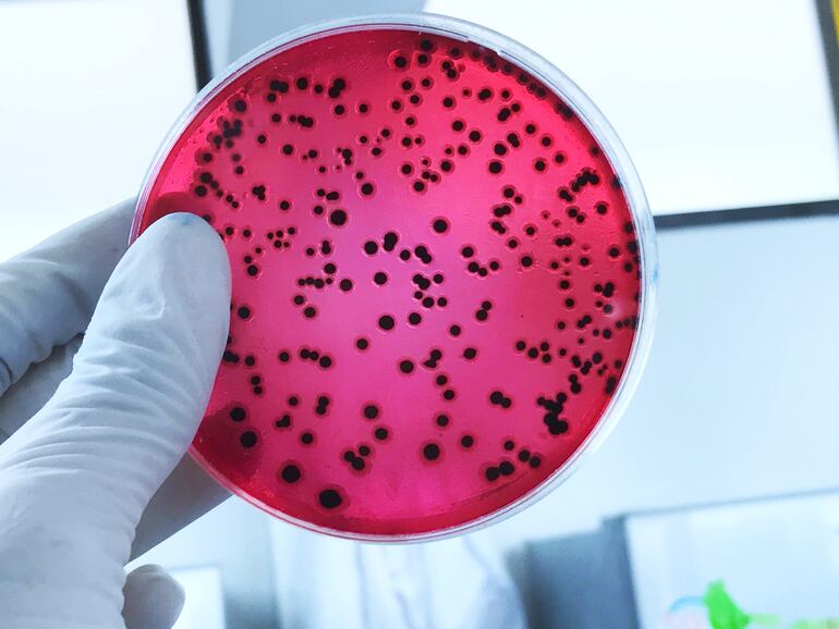 Colonia de salmonella en una placa de agar.