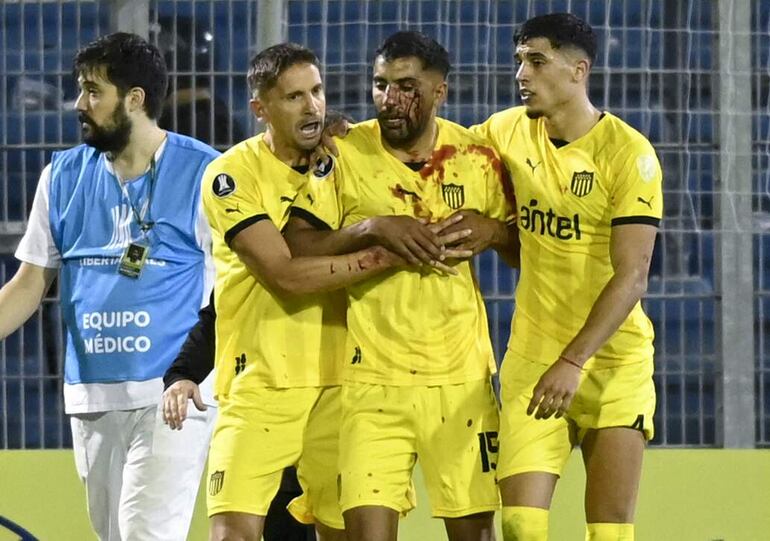 Maximiliano Olivera (c), futbolista de Peñarol, con sangre en el rostro después de recibir un piedrazo al finalizar el partido ante Rosario Central por la Copa Libertadores 2024 en el estadio Gigante de Arroyito, en Rosario, Argentina.