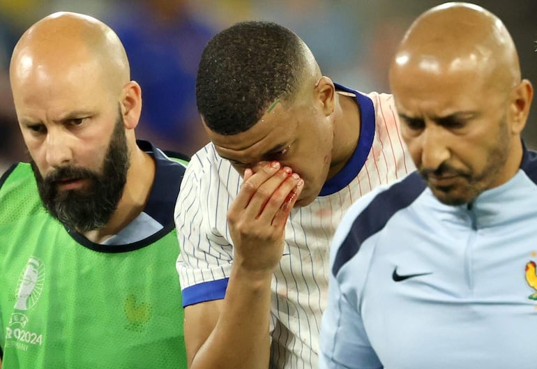 Kylian Mbappé sufrió la fractura de la nariz