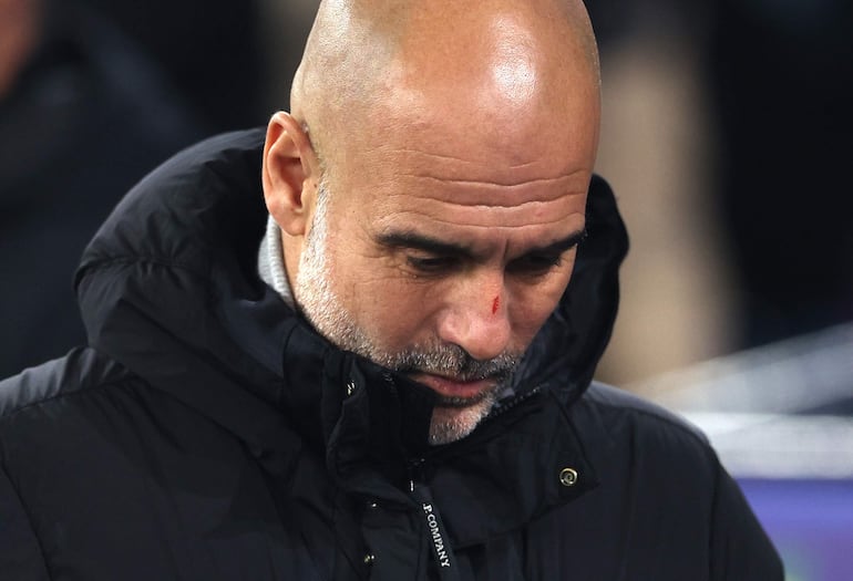 El español Pep Guardiola, entrenador del Manchester City, con el corte en la nariz ya durante el partido frente al Feyenoord por la Champions League 2024-2025.