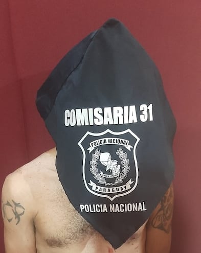 Este hombre fue detenido en San Lorenzo por herir a una persona con un machete.