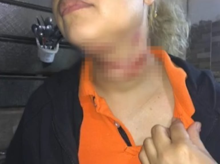 Cristina Gómez, de San Antonio, casi es decapitada por un cable suelto.