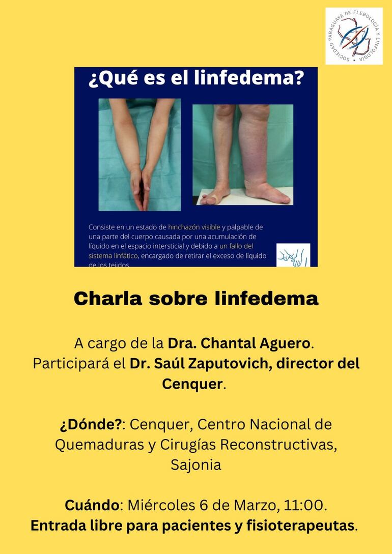 La Dra. Chantal Aguero dará una charla sobre linfedema en el Cenquer.