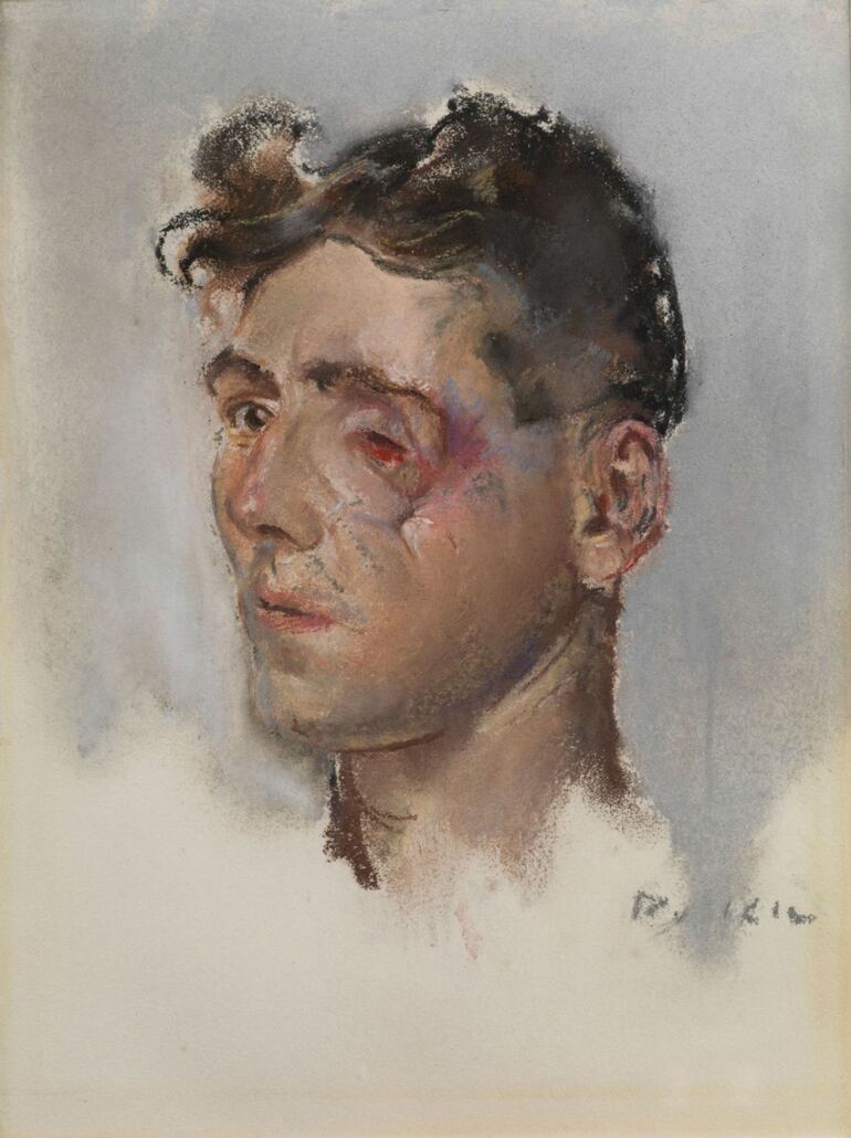 Henry Tonks: "Soldier with facial injuries" (1916)