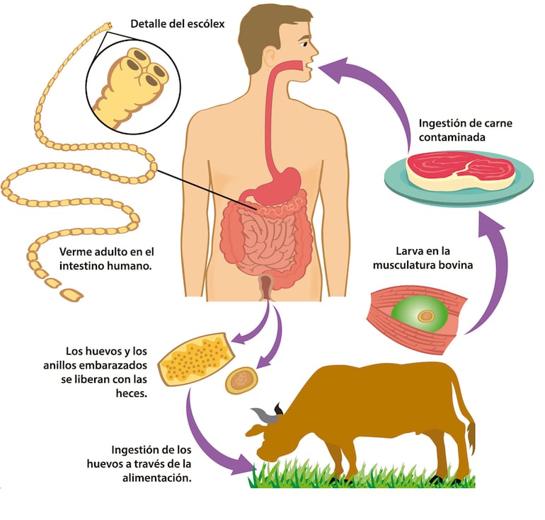 TENIASIS