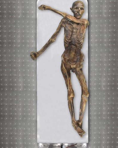 Ötzi, conocido como el Hombre de los Hielos, tiene más de 5.300 años de antigüedad y es la momia más antigua preservada en hielo que se conoce. Un equipo de expertos italianos y alemanes realizó un análisis genómico más completo y de mayor calidad que los logrados hasta ahora para conocer mejor la historia genética de Ötzi, el cual ha desvelado algunas sorpresas que publica hoy Cell Genomics. El análisis reveló rasgos fenotípicos como una elevada pigmentación de la piel, un color de ojos oscuro y una calvicie de patrón masculino que contrastan fuertemente con las reconstrucciones anteriores, que muestran a un varón de piel clara, ojos claros y bastante velludo".