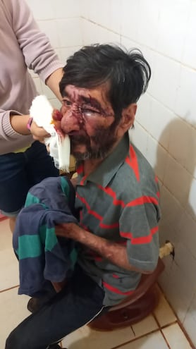 Don Jacinto Brítez, de Laurel, Canindeyú  víctima de una tremenda golpiza por parte de su hijo