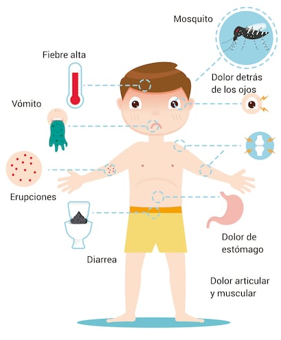 Síntomas del Dengue