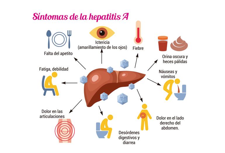 Algunos síntomas de la hepatitis. 