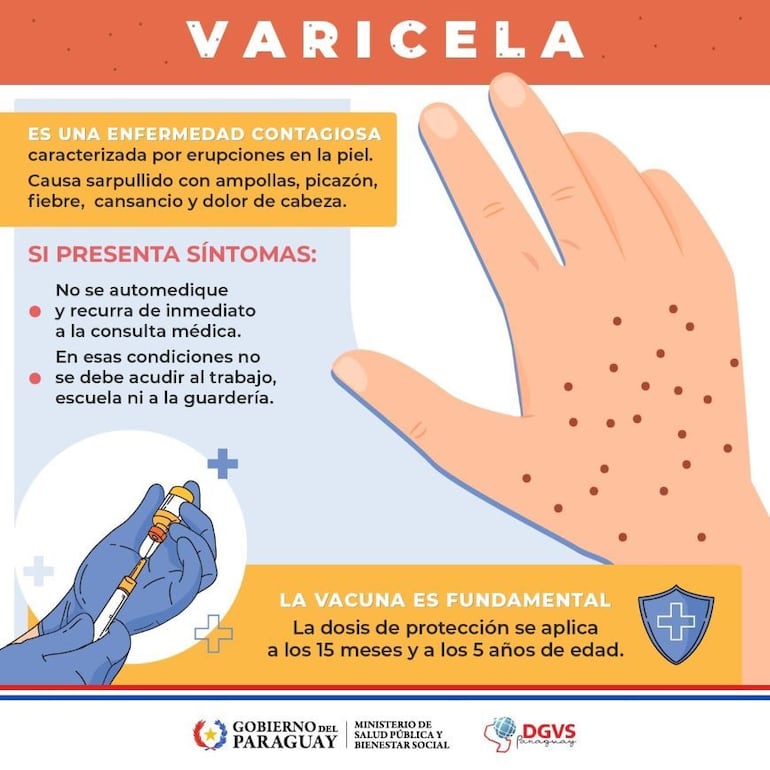 La vacuna es fundamental para prevenir la varicela, recuerda Salud.