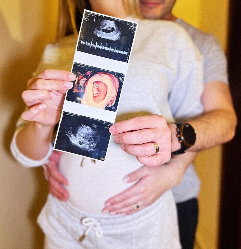 Con esta tierna postal, Daisy Lezcano y Hernán Bogarín anunciaron que serán papis. (Instagram/Daisy Lezcano)