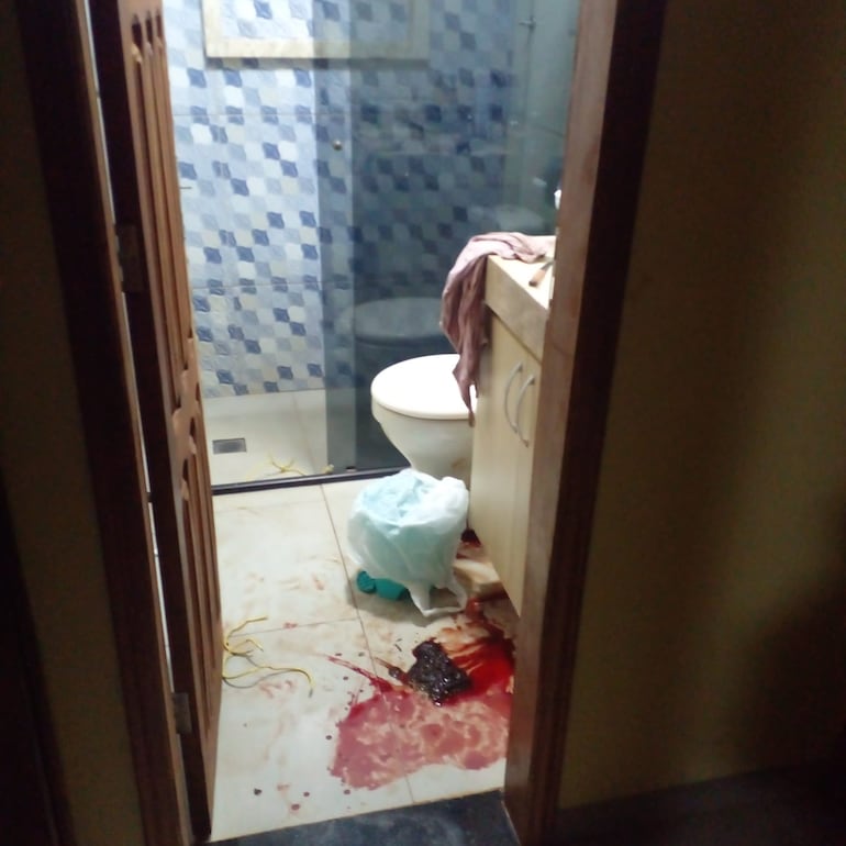 El abogado Edgar Daniel Prieto Meza fue brutalmente golpeado y dejado en el baño de su casa. Luego fue asistido por bomberos y derivado a un centro asistencial.