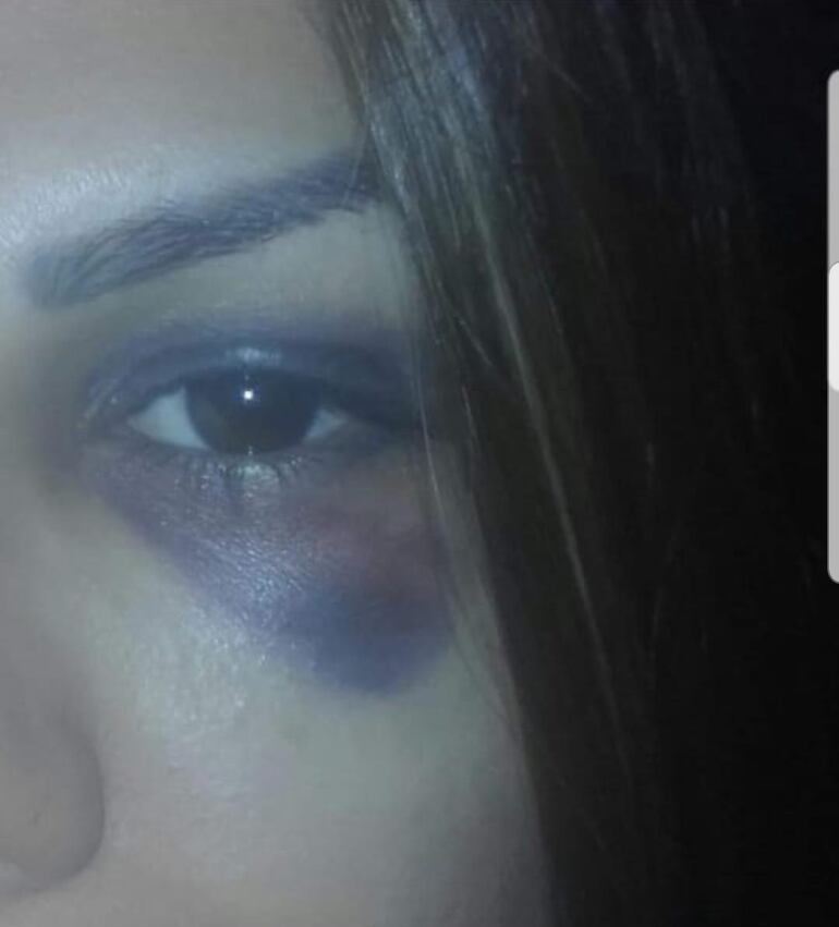 Gladys Rodríguez conserva la foto que se tomó en el 2015 cuando su marido la molió a golpes.